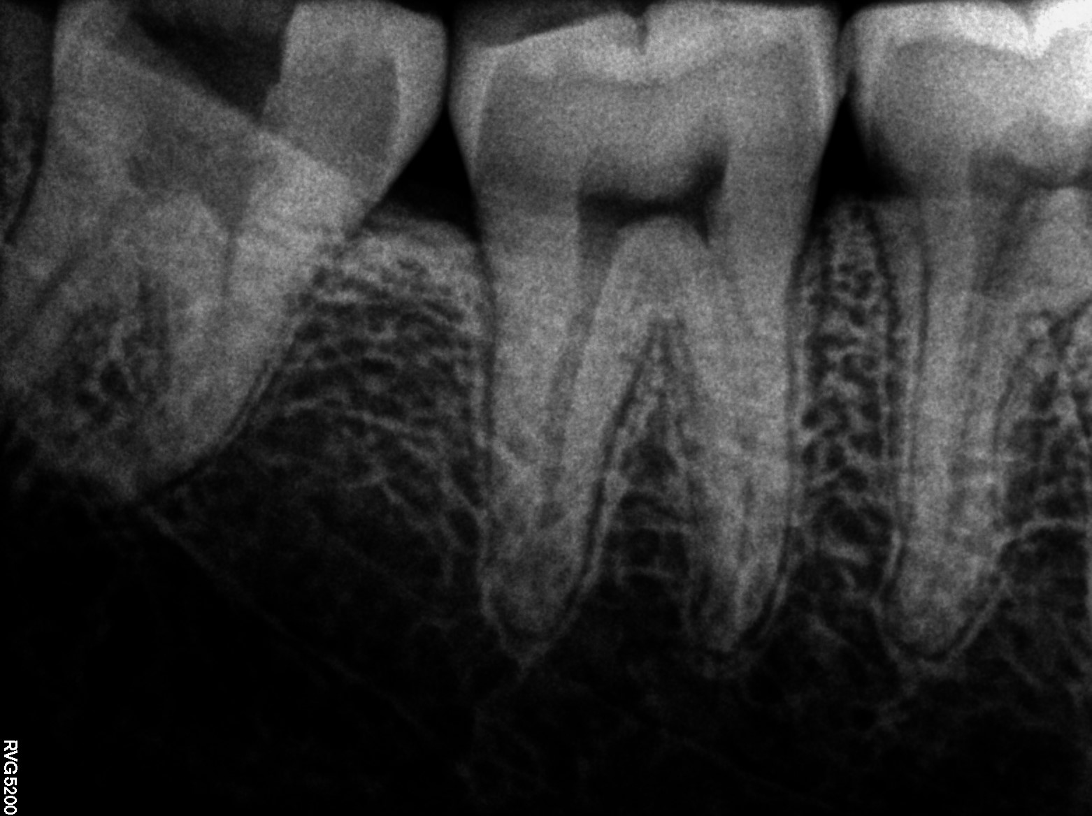 Dental X-ray